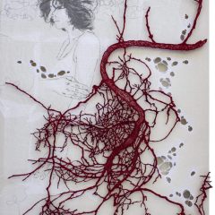 00001-arterie-smisurate-749x1024